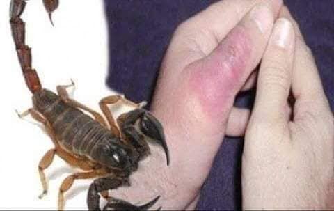 لدغة عقرب  تحيل تلميذة إلى المستشفى  قبل اجتياز اختبار الباكالوريا